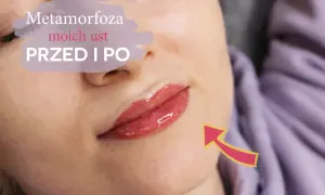 Metamorfoza moich ust przed i po. Efekt pięknych, lśniących ust permanentnych, podkreślonych subtelnym kolorem.