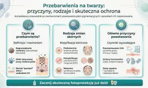Przewodnik po przebarwieniach na twarzy: przyczyny, rodzaje i ochrona. Dowiedz się, jak mel skin może pomóc w walce z plamami pigmentacyjnymi.