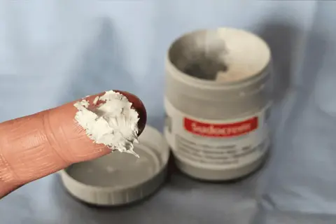 Czy Sudocrem jest dobry na pryszcze? Sprawdź jego skuteczność i ryzyko