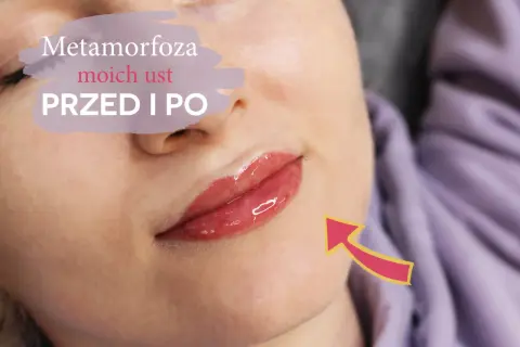 Metamorfoza moich ust przed i po. Efekt pięknych, lśniących ust permanentnych, podkreślonych subtelnym kolorem.