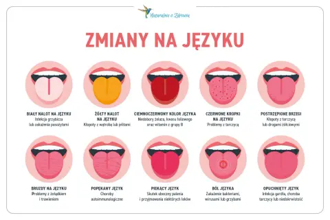 Skuteczne sposoby na pryszcz na języku – jak się pozbyć bólu i dyskomfortu