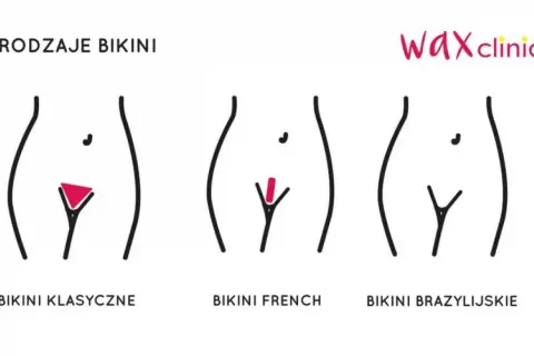 Ilustracja pokazuje rodzaje depilacji bikini: klasyczne, french i brazylijskie. Depilacja brazylijska efekty to gładkość.
