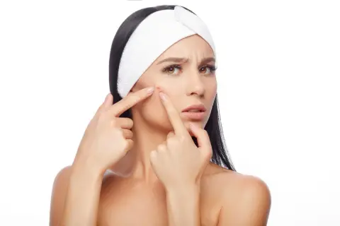 Zmartwiona kobieta z pryszczem na policzku szuka sposobów, jak szybko zagoić ranę po pryszczu domowe sposoby.