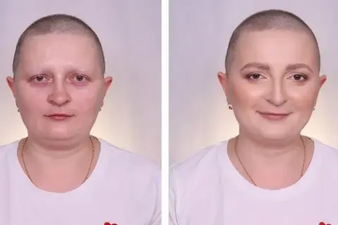 Czy po chemii wypadają brwi i rzęsy? Poznaj prawdę o skutkach terapii