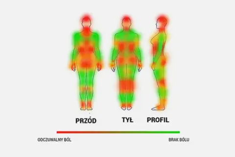 Mapa bólu: czerwone obszary pokazują, gdzie tatuaż boli najbardziej. Skala odczuwalnego bólu do braku bólu.