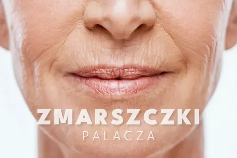 Widoczne głębokie zmarszczki wokół ust, charakterystyczne dla palacza. Skóra wokół ust jest pomarszczona.