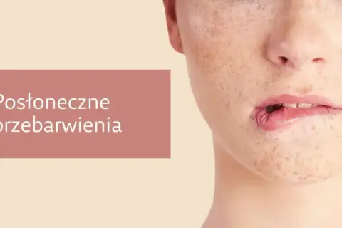 Zbliżenie na twarz z widocznymi przebarwieniami i piegami. Kobieta lekko przygryza dolną wargę.