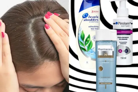 Szukasz skutecznych rozwiązań na łupież? Sprawdź pirolam opinie i porównaj z Head & Shoulders i Pharmaceris.