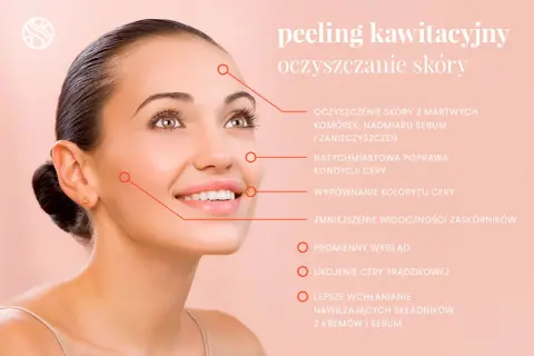 Peeling kawitacyjny: oczyszczenie, poprawa kondycji, wyrównanie kolorytu, redukcja zaskórników, promienny wygląd. Brak negatywnych efektów ubocznych.
