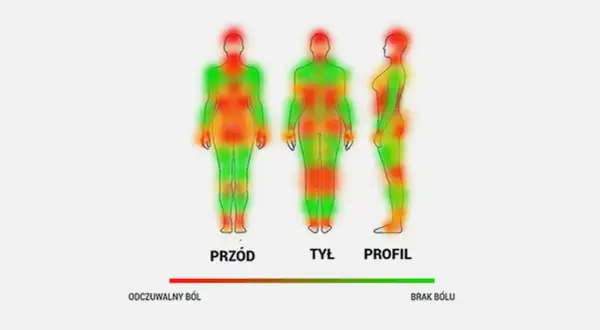 Mapa bólu: czerwone obszary pokazują, gdzie tatuaż boli najbardziej. Skala odczuwalnego bólu do braku bólu.