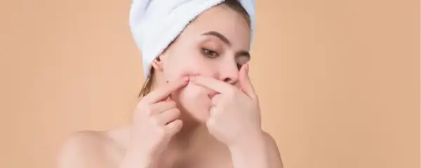 Dlaczego wyciskanie pryszczy jest przyjemne i co to oznacza dla ciebie