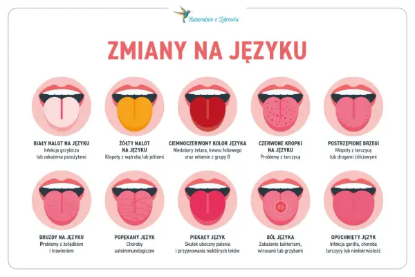 Skuteczne sposoby na pryszcz na języku – jak się pozbyć bólu i dyskomfortu