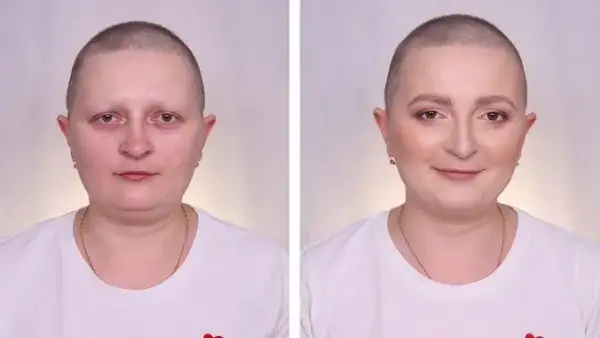 Czy po chemii wypadają brwi i rzęsy? Poznaj prawdę o skutkach terapii