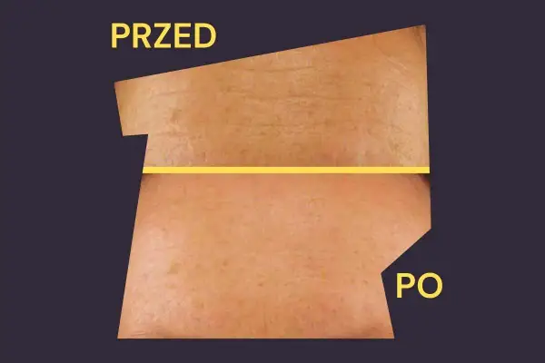 Przed i po zabiegu: skóra z widocznymi zmarszczkami i przebarwieniami staje się gładsza i jaśniejsza. Revibel opinie potwierdzają skuteczność.