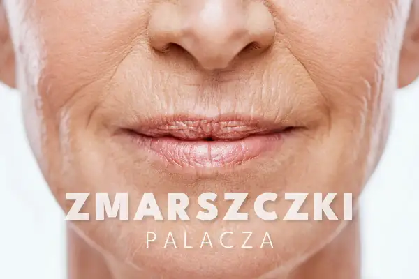 Widoczne głębokie zmarszczki wokół ust, charakterystyczne dla palacza. Skóra wokół ust jest pomarszczona.