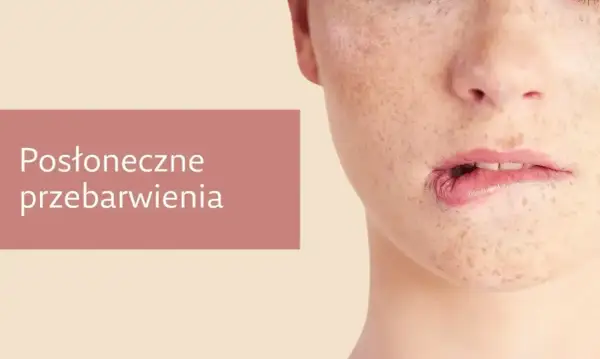 Zbliżenie na twarz z widocznymi przebarwieniami i piegami. Kobieta lekko przygryza dolną wargę.