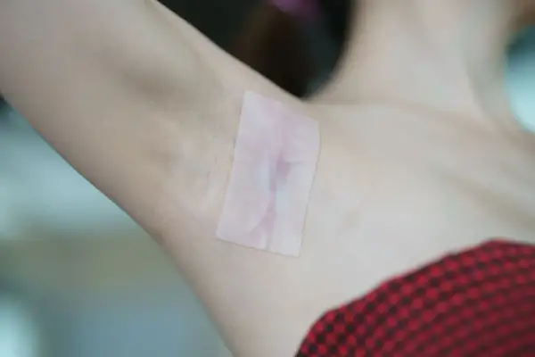 Plaster na bliznę pod pachą. Blizna po zabiegu staje się mniej widoczna dzięki specjalnej taśmie.